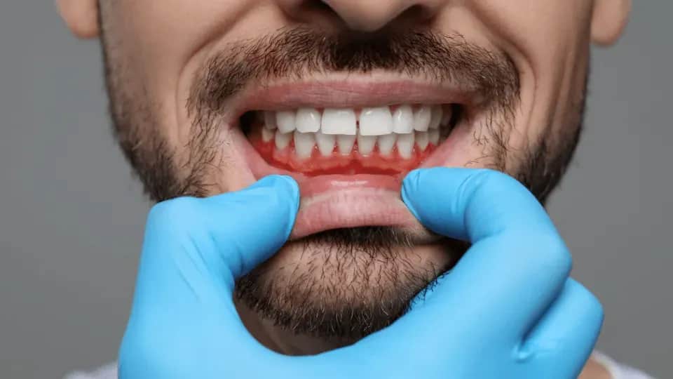 Jak wzmocnić dziąsła? Pełny poradnik: dieta, higiena, domowe sposoby