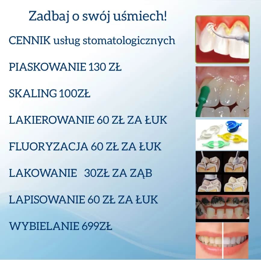 Koszt leczenia kanałowego zęba: Ceny, NFZ, na co uważać?